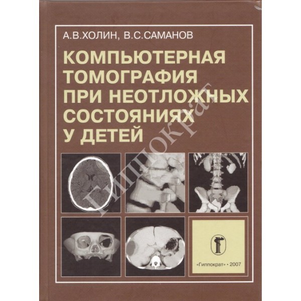 Компьютерная томография при неотложных состояниях у детей - Холин А.В., Саманов В.С.