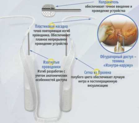 Устройство TVT-Obturator, стерильное, одноразовое 810081