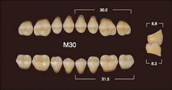 Частичный гарнитур 8шт. Жевательные верхние A4 M30