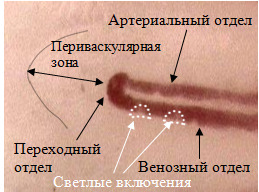 Капилляроскоп