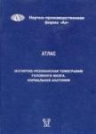 Магнитно-резонансная томография головного мозга, атлас